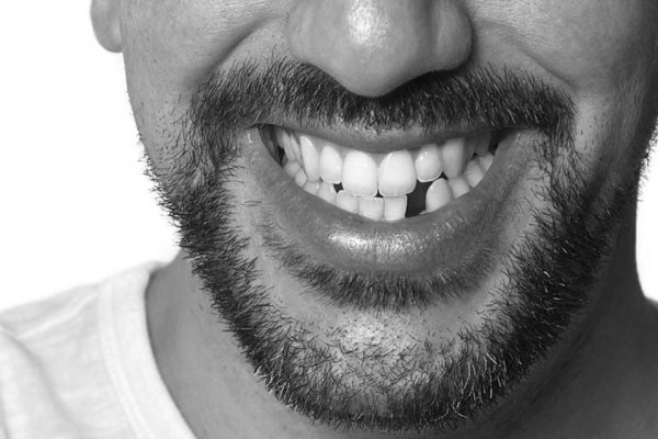 Diş Kaybının Riskleri Var Mı?