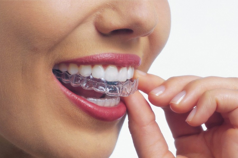 Invisalign Şeffaf Plak